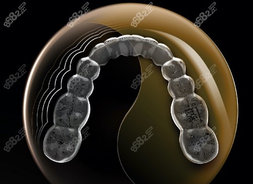 德州可恩口腔医院时代天使comfos隐形矫正的优势