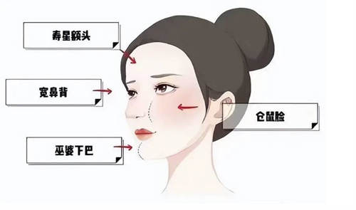 馒化脸哪个医生做的好?2025馒化脸去除|修复医生名单分享