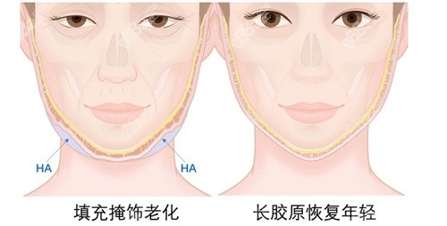 馒化脸修复医生推荐名单