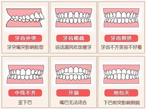 DamonQ和DamonQ2的区别详解：DamonQ2矫正更有效、更快、更舒适