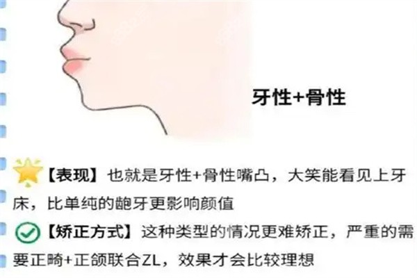 柳春明医生凸嘴挂号 