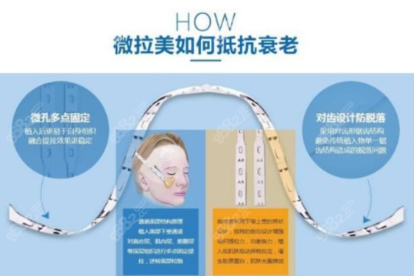 微拉美面部提升如何抗衰