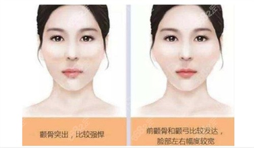 刘正茂医生怎么样
