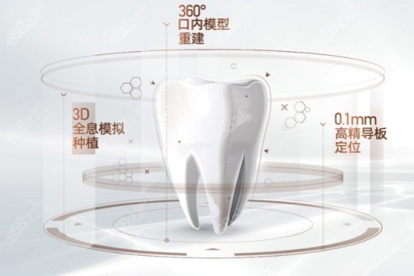 杭州团圆口腔医院种植牙怎么样
