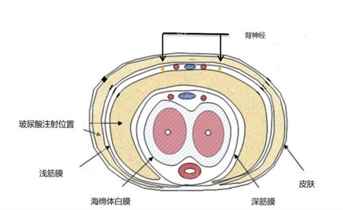 生物补片是什么材料