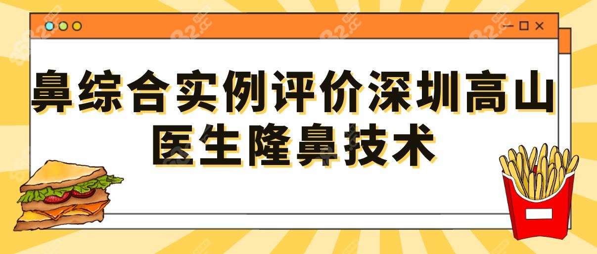 鼻综合实例评价深圳高山医生隆鼻技术