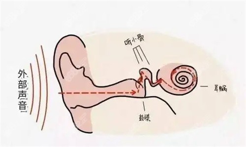 国内排名前十义耳定做机构