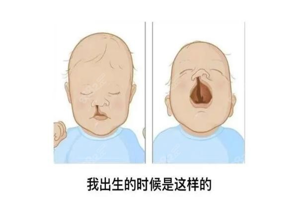 唇腭裂手术医院排行榜前十