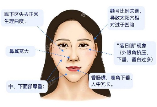 馒化脸修复好的医生技术优势介绍