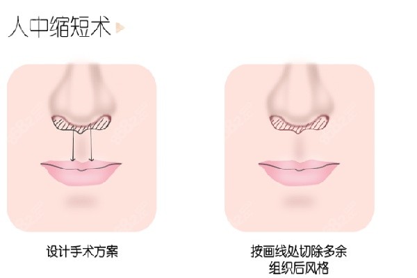 人中缩短无痕术医生实力排行榜