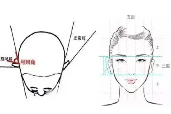 郭志华耳再造真实病例疗效追踪