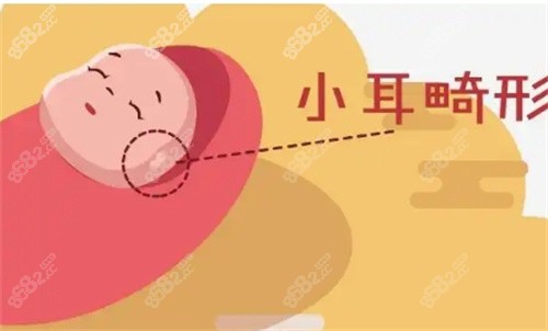 陈再洪医生做贴面耳矫正价格