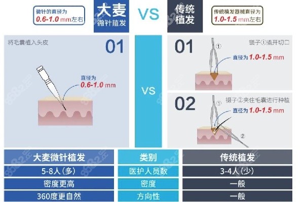 大麦微针植发技术