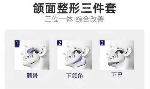 朱乐林磨骨三件套多少钱