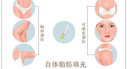 万友望医生擅长什么项目