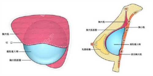 三、刘成胜丰胸是打广告出来吗？