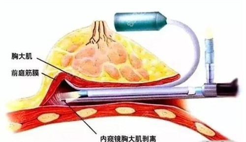 十三、如何预约刘成胜的手术