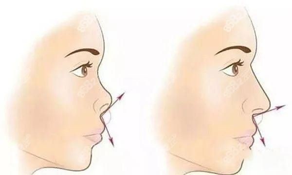 深圳张辉做鼻子价格
