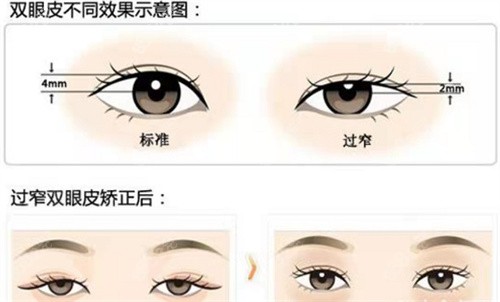 一、眼修复吕方中2025在哪家医院怎么联系?