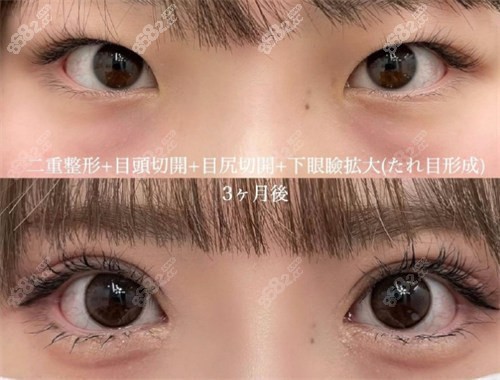 杜园园是谁？为什么她的修复手术如此受欢迎？