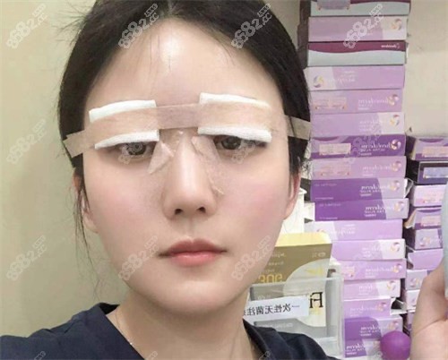 杜园园修复手术的实例分享