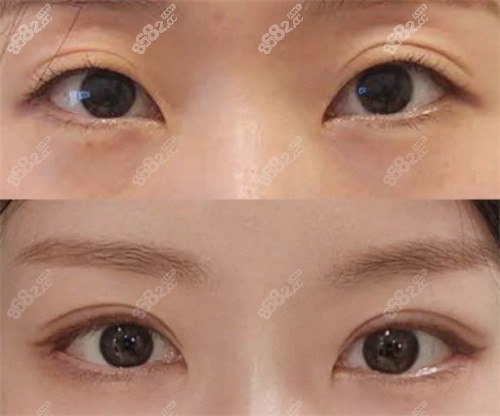 杜园园是谁？为什么她的修复手术如此受欢迎？