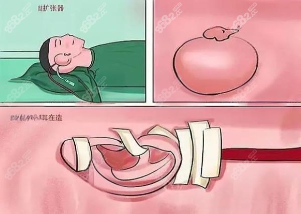 八大处谢春洋耳再造技术怎么样