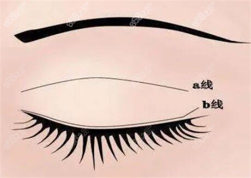 一、瑞丽整形美容医院双眼皮价格-2025新版：