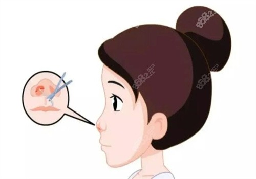 陳樹科美容外科醫(yī)生技術(shù)怎么樣