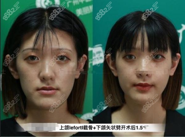 广州广大整形医院怎么样