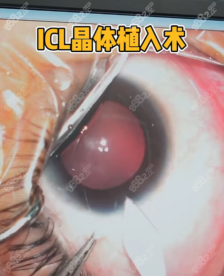 安徽省立医院眼科预约挂号