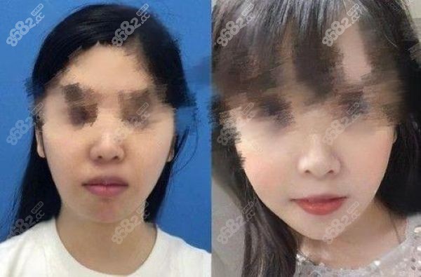 广州广大整形医院正颌怎么样