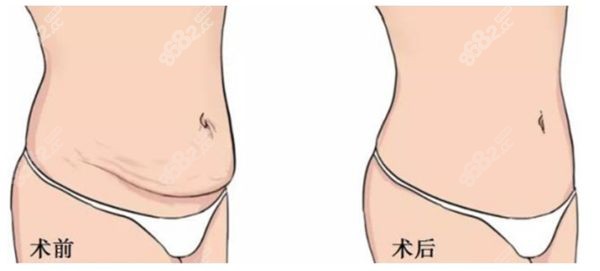 深圳阳光整形美容医院怎么样