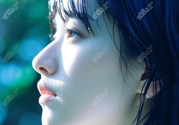 谢洋春拉皮手术为什么这么火？