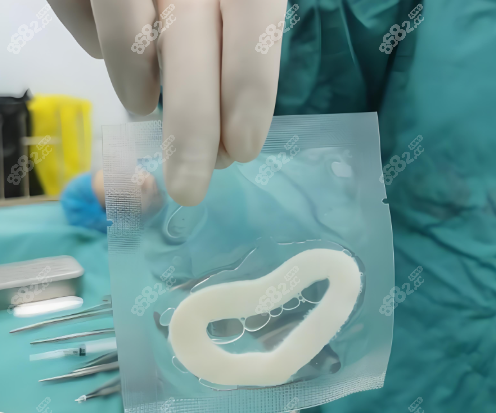 3D生物束帶