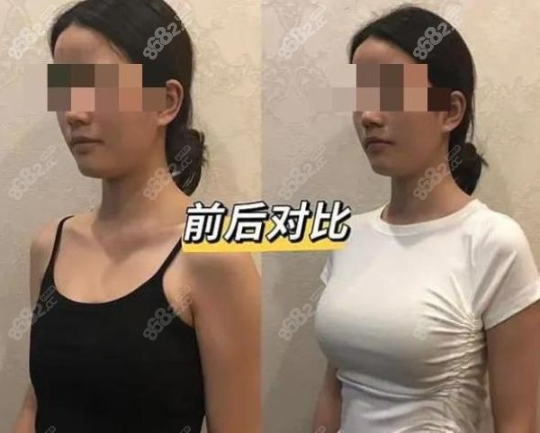 國內(nèi)隆胸醫(yī)生排名