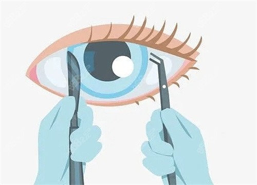 合肥慧视眼科的口碑如何？虽未定级但医院资质正规评价好