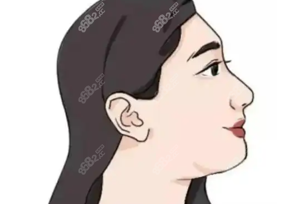 肖林医生做下颌骨修复|正颌手术的三大硬核优势
