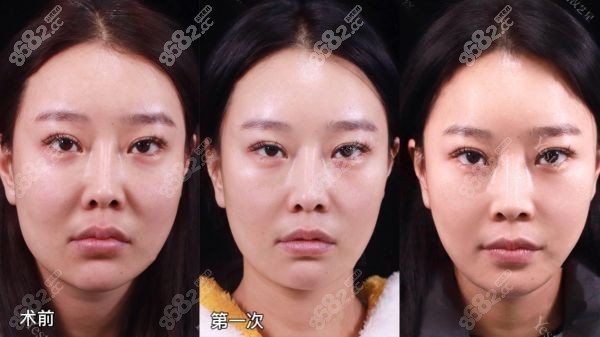 吴贞跃医生口碑怎么样