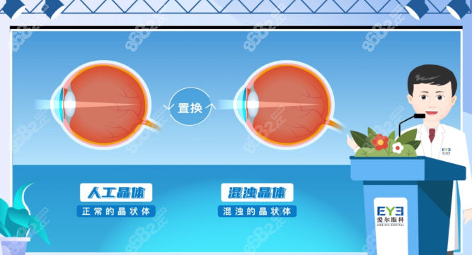 爱尔眼科白内障免费治疗政策
