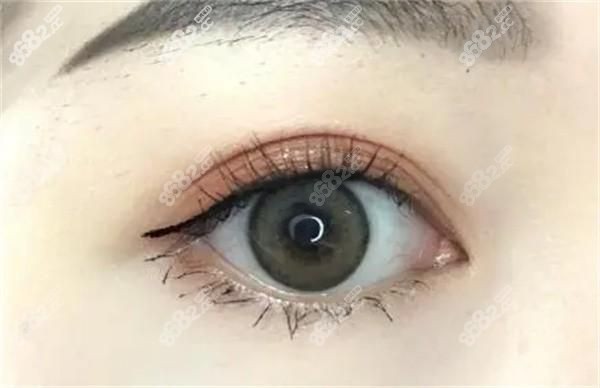 鄭州賀潔做眼袋修復(fù)怎么樣