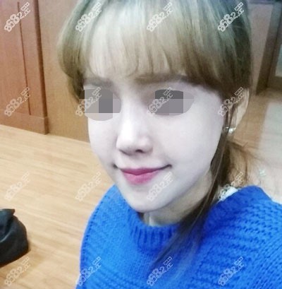 面部饱满合适才是真的美