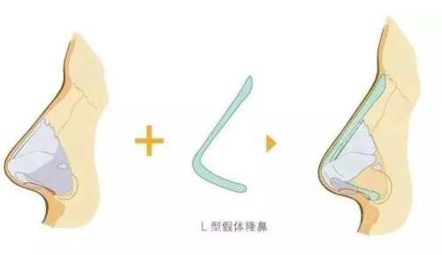 重慶軍美章小平鼻子做的怎么樣