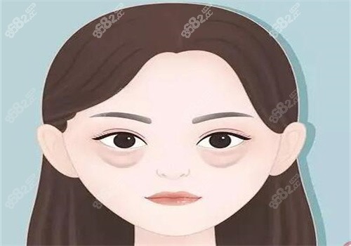 梁志生去眼袋做的怎么样