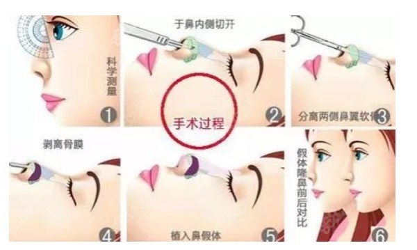 重慶軍美章小平鼻子做的怎么樣
