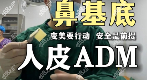ADM填充鼻基底
