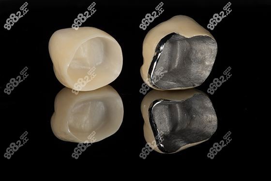 全瓷牙示意圖2www.sorencai.cn 全瓷牙示意圖2www.sorencai.cn