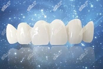 全瓷牙示意圖1 全瓷牙示意圖1