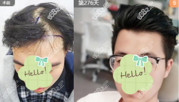 天津大麥植發(fā)<span style=