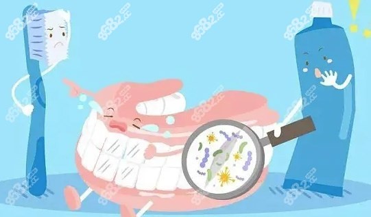 清洁牙齿